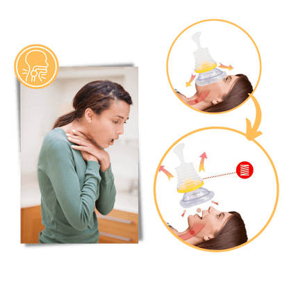 AirwayClear™ Anti-Choking Device